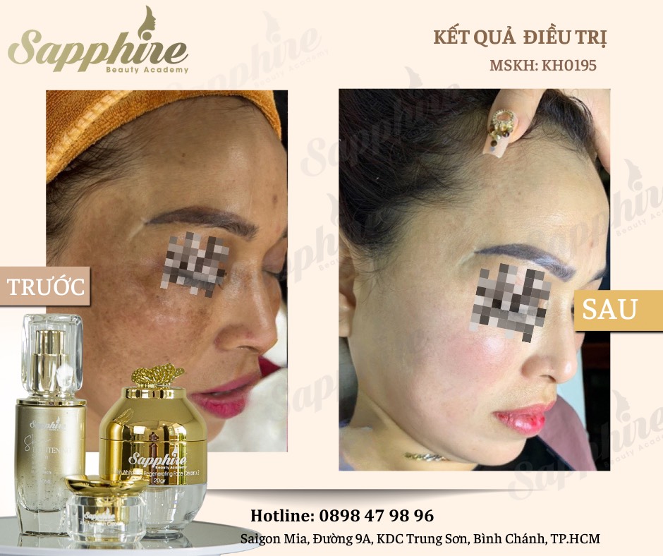 Kem Dưỡng Loại Bỏ Sừng Hóa Da Sapphire Anti-Aging Skin Cream 9