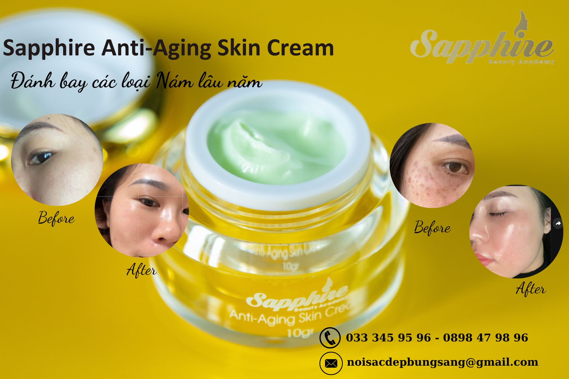 Kem Dưỡng Loại Bỏ Sừng Hóa Da Sapphire Anti-Aging Skin Cream 4