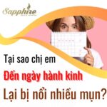 Tại sao chi em đến ngày hành kinh lại bị nổi nhiều mụn?