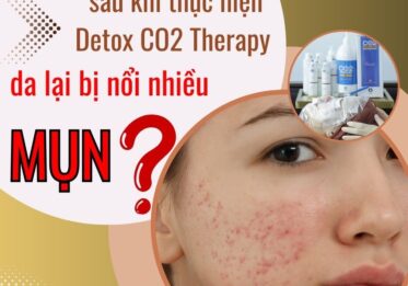 Vì sao sau khi thực hiện detox da CO2 Therapy da lại bị nổi nhiều mụn.Sapphirebeauty