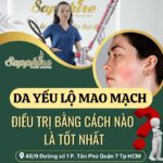 Da yếu lộ mao mạch thì điều trị bằng cách nào là tốt nhất??