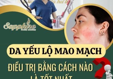 Da yếu lộ mao mạch thì điều trị bằng cách nào là tốt nhất??