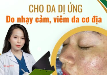 Giải pháp cho da dị ứng do nhạy cảm, viêm da cơ địa