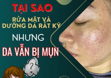 Tại sao rửa mặt và dưỡng da rất kỹ nhưng da vẫn bị mụn