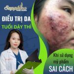 Điều trị da tuổi dậy thì khi sử dụng mỹ phẩm sai cách