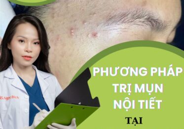 Phương pháp trị mụn nội tiết tại Sapphire Beauty Academy