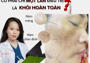 Chữa nám có phải một lần điều trị là khỏi hoàn toàn ?
