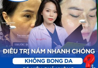 Điều trị nám không bong có được không?