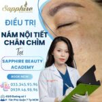 Điều trị nám nội tiết chân chìm tại Sapphire Beauty Academy quận 7