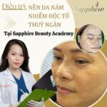 Điều trị nền da nám, nhiễm độc tố thuỷ ngân tại Sapphire Beauty Academy